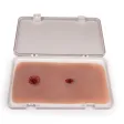 Wundmoulage mit Blutungsfunktion
