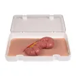 Wundmoulage