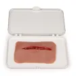 Wundmoulage