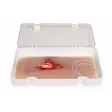 Wundmoulage mit Blutungsfunktion