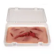 Wundmoulage mit Blutungsfunktion