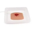 Wundmoulage Wound Packing