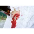 Wundmoulage